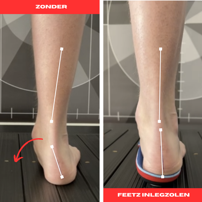 Feetz® Blue One | Ultiem Hielcomfort